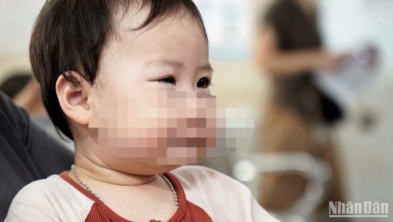 Đau mắt đỏ ở trẻ em Khi nào cần đưa trẻ đi khám