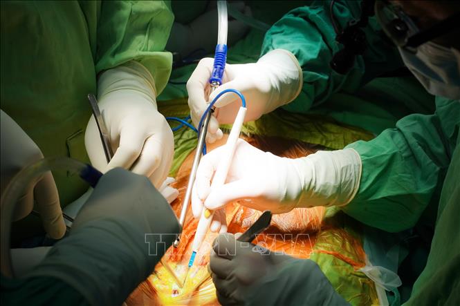 Sáu bệnh nhân được hồi sinh nhờ ghép tạng trong dịp nghỉ lễ 30 4