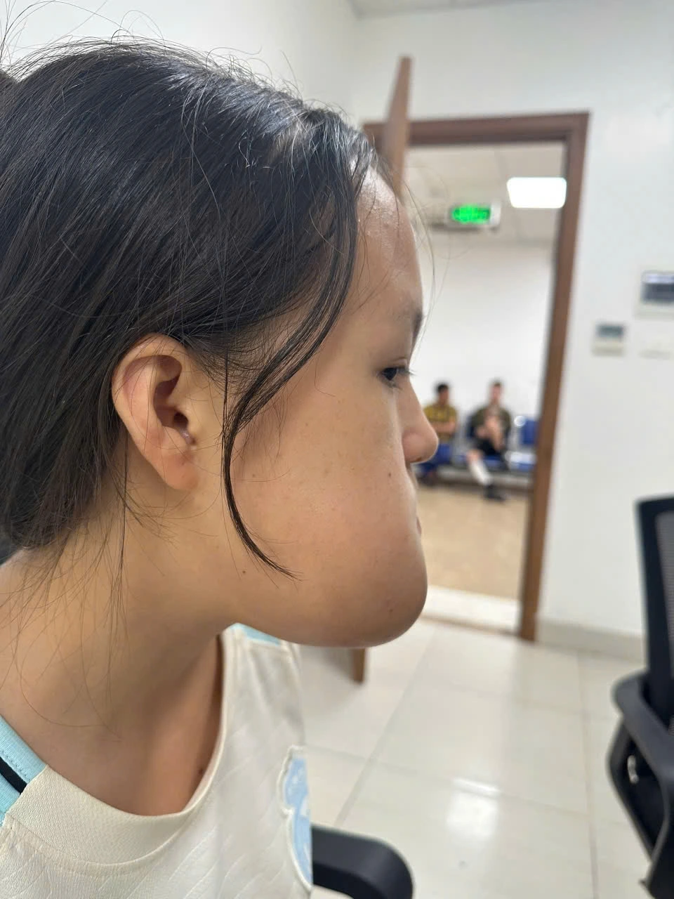 9 giờ phẫu thuật để loại bỏ khối u và tái tạo gương mặt cho bé gái vùng cao