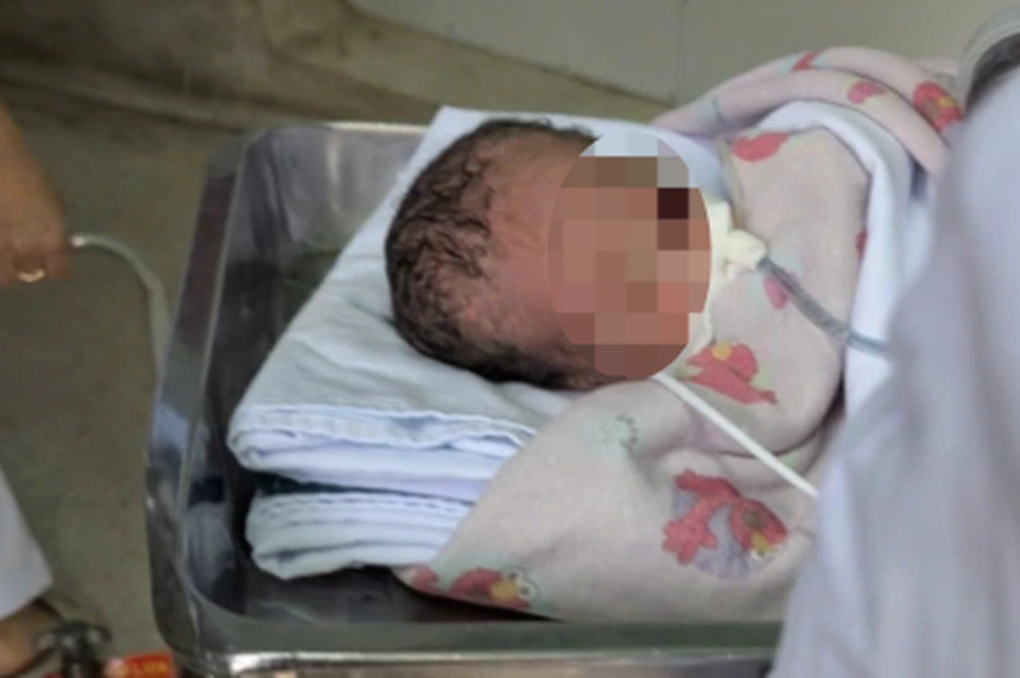 Hai trẻ sơ sinh ngưng tim, ngưng thở được cứu sống kịp thời