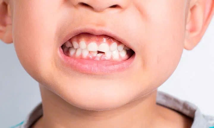 Những thói quen xấu khiến răng nhanh hỏng