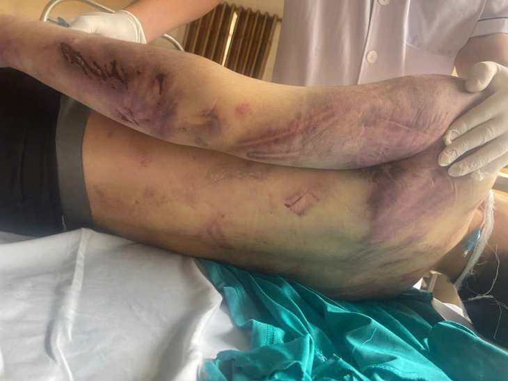 Học viên Trung tâm công tác xã hội Hải Hà tử vong sau 2 ngày nhập học, công an tạm giữ 8 người