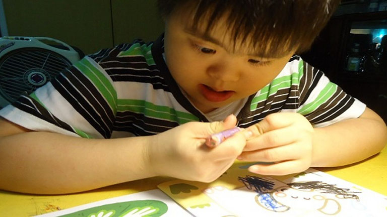 Các dạng khuyết tật ở trẻ Biểu hiện và hướng can thiệp Phần I