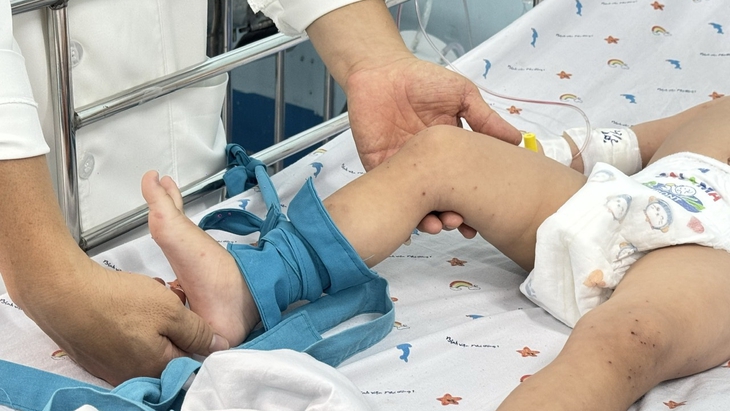 TPHCM Bệnh tay chân miệng tăng cấp, 3 ca tử vong