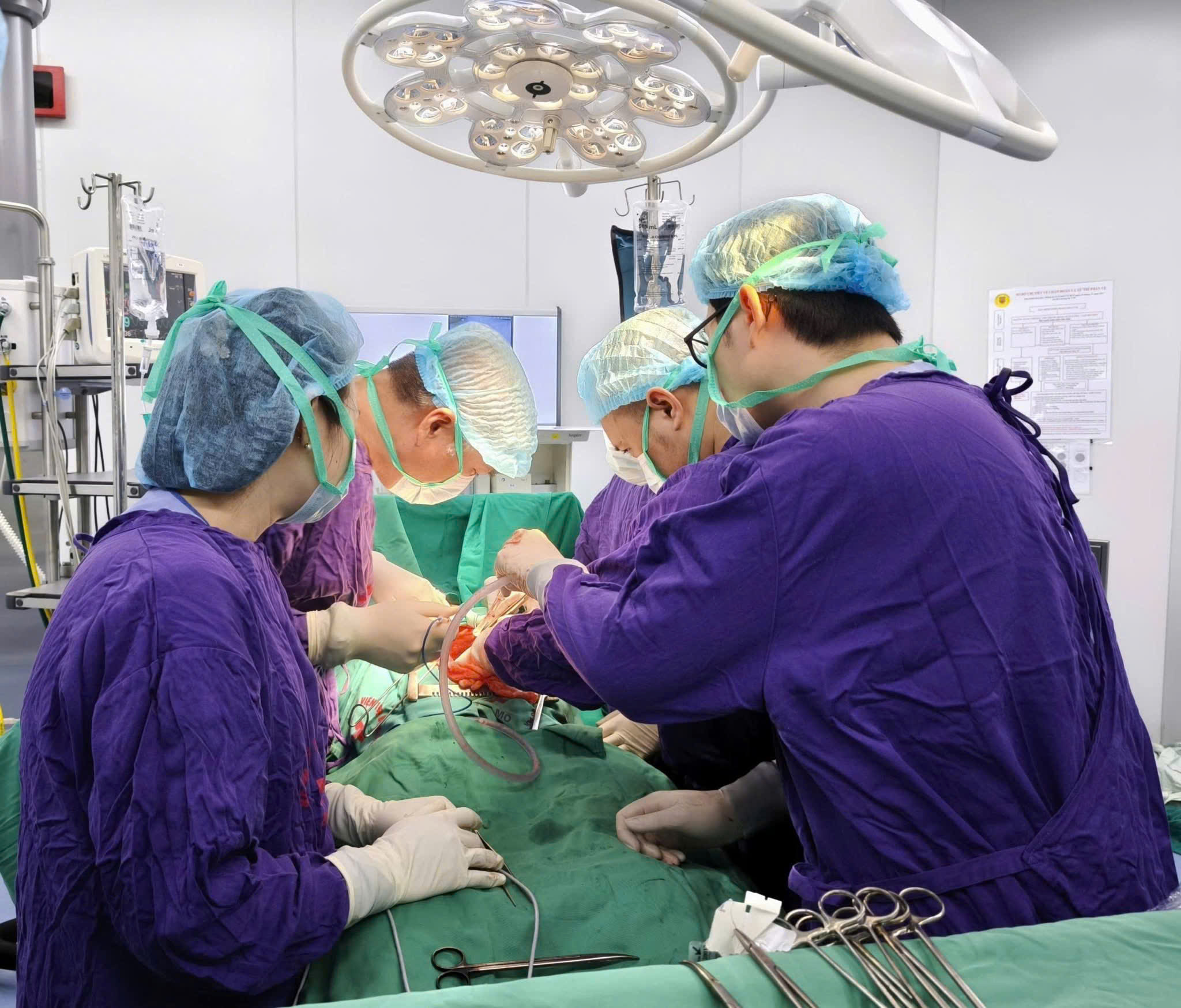 Phẫu thuật thành công ca bệnh ung thư đại tràng di căn gan phức tạp