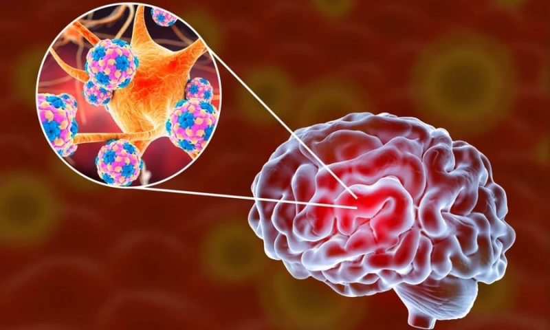 Gia tăng số ca mắc viêm màng não mô cầu