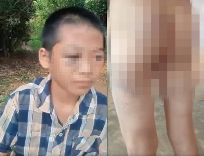 Chi tiết cực đắt trong vụ bé lớp 6 nghi bị mẹ kế và cha bạo hành Chúng ta cần nhìn lại để dạy con mình