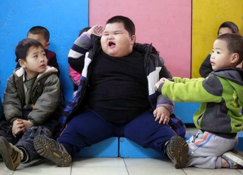 Béo phì ở trẻ nguy hiểm hơn bạn nghĩ