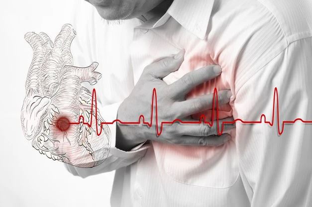 Đột quỵ mùa nắng nóng, nhận diện dấu hiệu và nguyên tắc sơ cứu