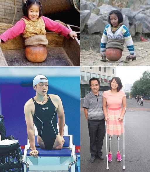 Ý chí và nghị lực của Cô bé bóng rổ