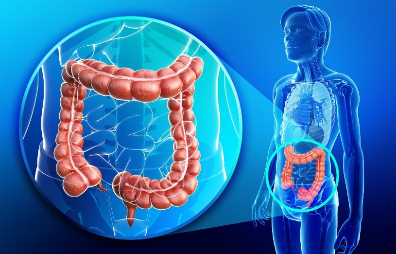 Bác sĩ cảnh báo dấu hiệu ung thư đại trực tràng dễ bị bỏ qua