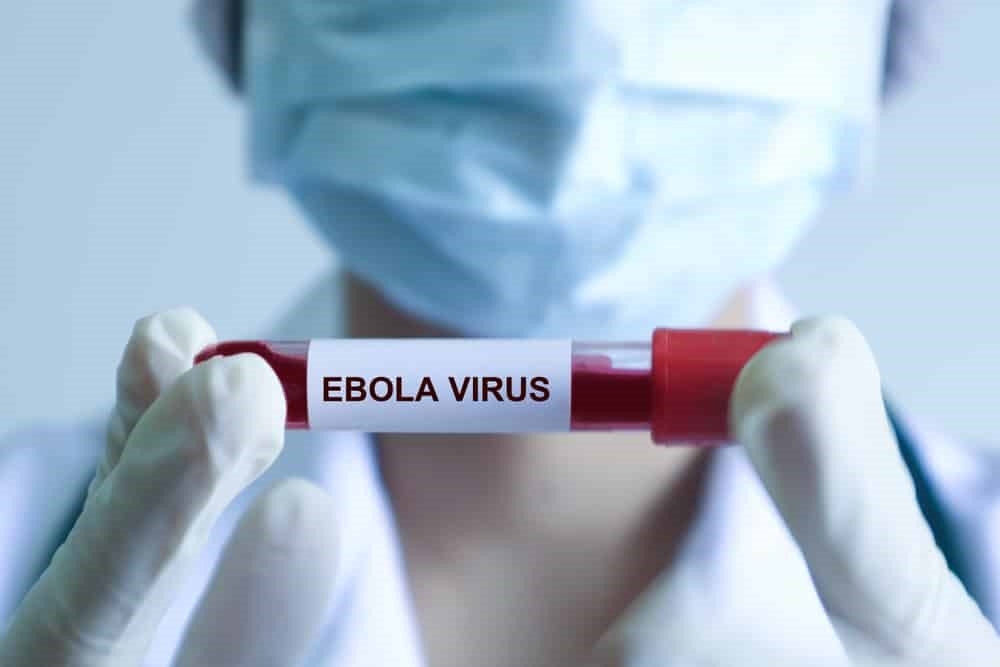 Hướng dẫn mới về chẩn đoán, điều trị bệnh do virus Ebola