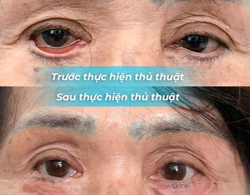 Bệnh viện Thống Nhất vừa tiếp nhận ca tai biến sau phẫu thuật thẩm mỹ
