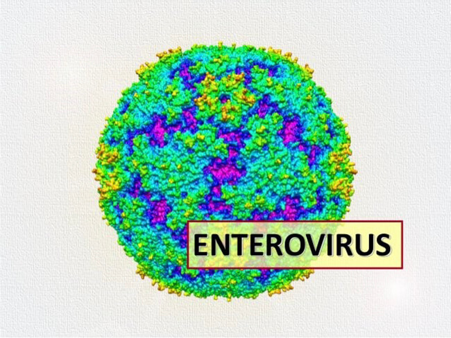 Enterovirus, virus viêm màng não